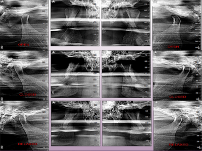 Insights Diagnostic CBCT Scan Services 2d tmj 6 views